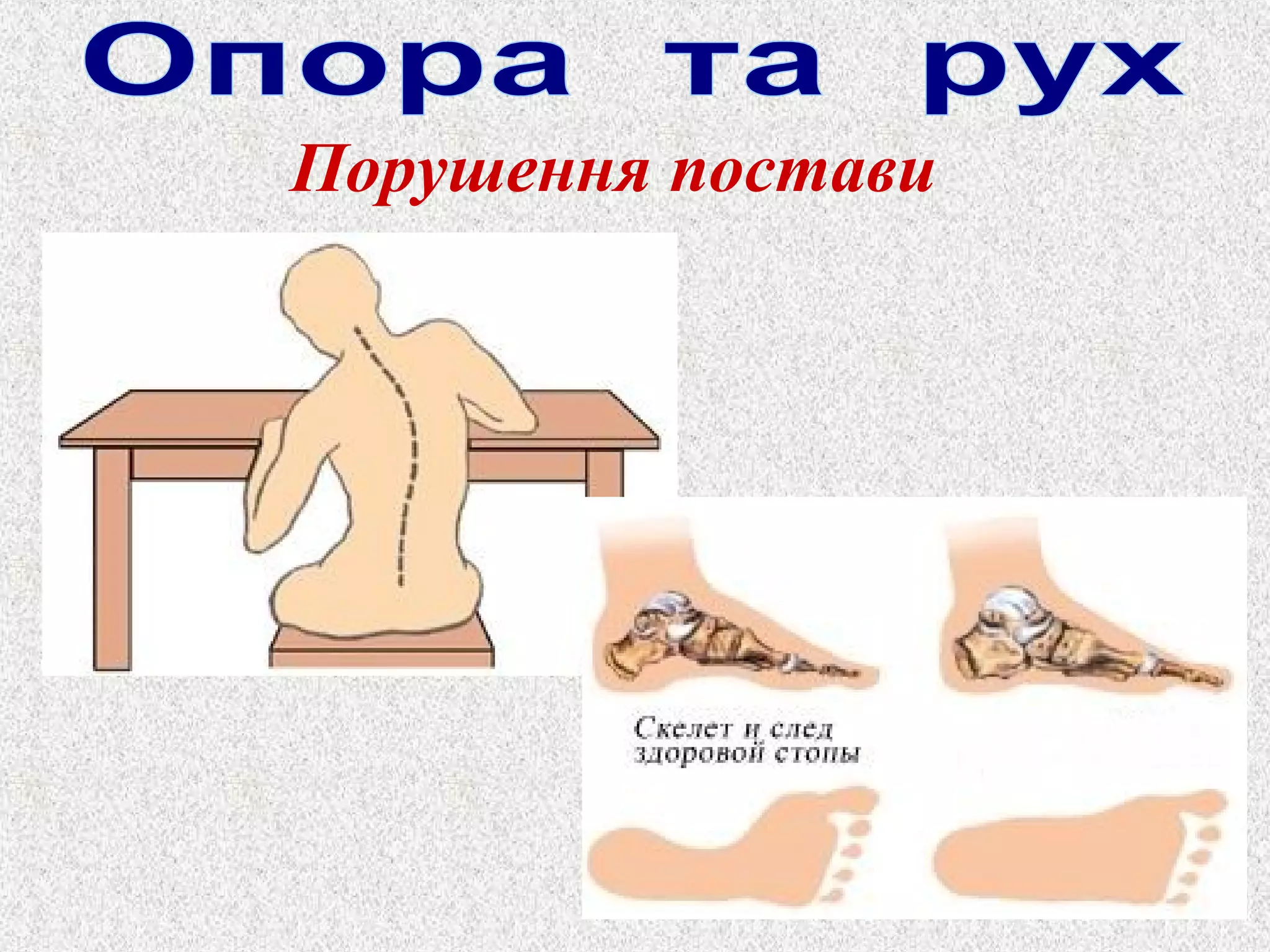 Порушення постави 
 