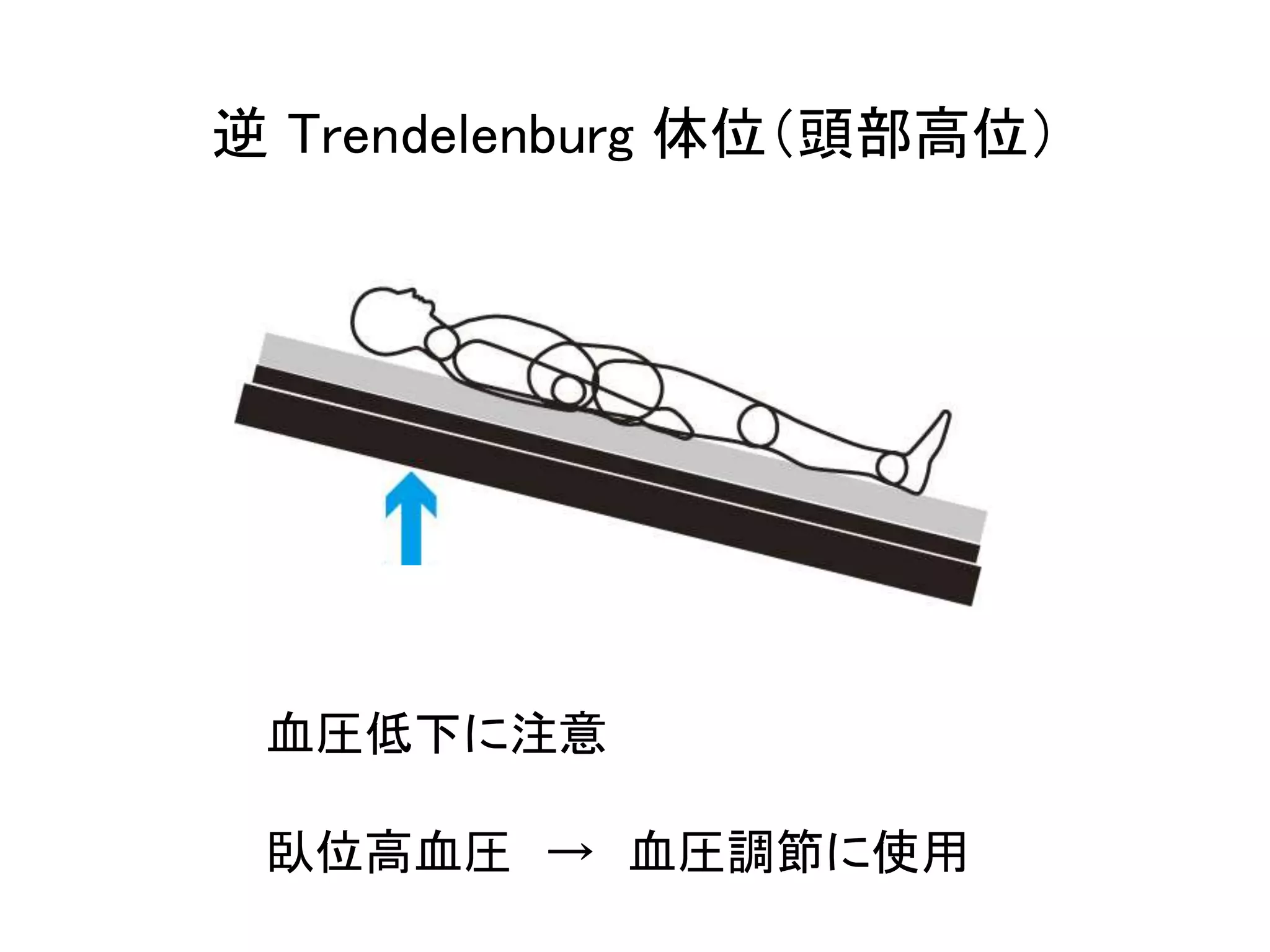 逆Trendelenburg 体位（頭部高位） 
血圧低下に注意 
臥位高血圧→ 血圧調節に使用 
 