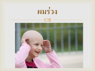  
ผมร่วง  