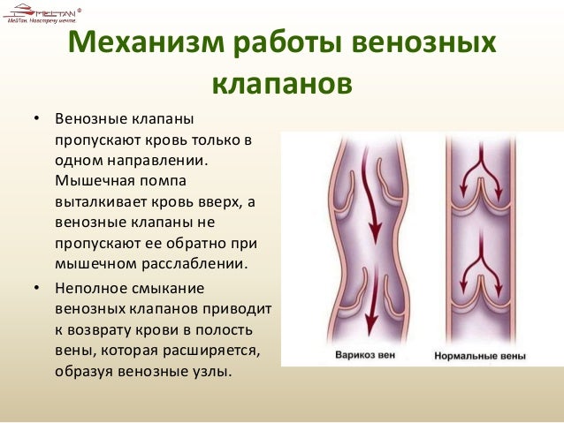 Венозные клапаны что делают