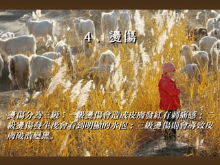 44、燙傷
燙傷分為三級︰一級燙傷會造成皮膚發紅有刺痛感；；二
級燙傷發生後會看到明顯的水泡；；三級燙傷則會導致皮
膚破潰變黑。
 