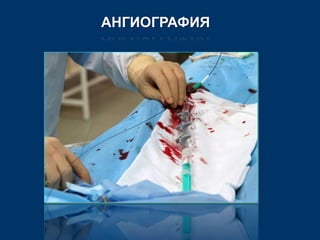 АНГИОГРАФИЯ 
 