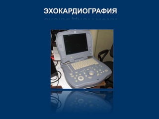 ЭХОКАРДИОГРАФИЯ 
 