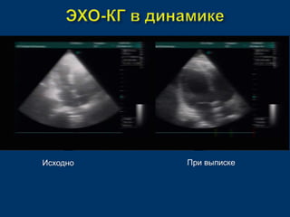 Исходно При выписке 
 