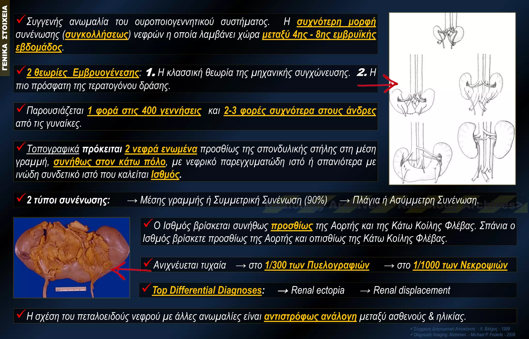Ανιχνέυεται τυχαία → στο 1/300 των Πυελογραφιών → στο 1/1000 των Νεκροψιών 
H σχέση του πεταλοειδούς νεφρού με άλλες ανωμαλίες είναι αντιστρόφως ανάλογη μεταξύ ασθενούς & ηλικίας. 
Παρουσιάζεται 1 φορά στις 400 γεννήσεις και 2-3 φορές συχνότερα στους άνδρες από τις γυναίκες. 
Top Differential Diagnoses: → Renal ectopia → Renal displacement 
Ο Ισθμός βρίσκεται συνήθως προσθίως της Αορτής και της Κάτω Κοίλης Φλέβας. Σπάνια ο Ισθμός βρίσκετε προσθίως της Αορτής και οπισθίως της Κάτω Κοίλης Φλέβας. 
2 τύποι συνένωσης: → Μέσης γραμμής ή Συμμετρική Συνένωση (90%) → Πλάγια ή Ασύμμετρη Συνένωση. 
Tοπογραφικά πρόκειται 2 νεφρά ενωμένα προσθίως της σπονδυλικής στήλης στη μέση γραμμή, συνήθως στον κάτω πόλο, με νεφρικό παρεγχυματώδη ιστό ή σπανιότερα με ινώδη συνδετικό ιστό που καλείται Ισθμός. 
Συγγενής ανωμαλία του ουροποιογεννητικού συστήματος. Η συχνότερη μορφή συνένωσης (συγκολλήσεως) νεφρών η οποία λαμβάνει χώρα μεταξύ 4ης - 8ης εμβρυϊκής εβδομάδος. 
2 θεωρίες Εμβρυογένεσης: 1. Η κλασσική θεωρία της μηχανικής συγχώνευσης. 2. Η πιο πρόσφατη της τερατογόνου δράσης. 
Σύγχρονη Διαγνωστική Απεικόνιση - Λ. Βλάχος - 1999 
Diagnostic Imaging: Abdomen - Michael P. Federle - 2009 ΓΕΝΙΚΑ ΣΤΟΙΧΕΙΑ  