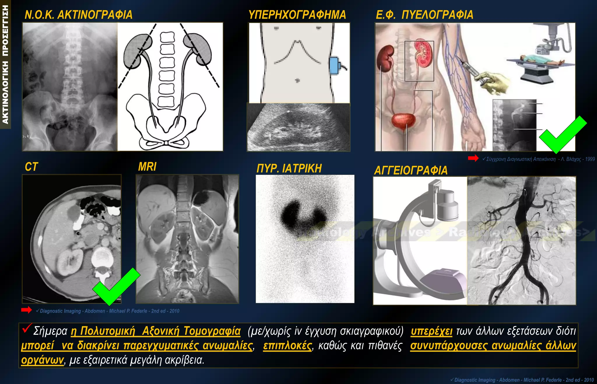 Ε.Φ. ΠΥΕΛΟΓΡΑΦΙΑ 
Ν.Ο.Κ. ΑΚΤΙΝΟΓΡΑΦΙΑ 
ΥΠΕΡΗΧΟΓΡΑΦΗΜΑ 
ΑΓΓΕΙΟΓΡΑΦΙΑ 
CT 
Σύγχρονη Διαγνωστική Απεικόνιση - Λ. Βλάχος - 1999 ΑΚΤΙΝΟΛΟΓΙΚΗ ΠΡΟΣΕΓΓΙΣΗ 
Diagnostic Imaging - Abdomen - Michael P. Federle - 2nd ed - 2010 
Σήμερα η Πολυτομική Αξονική Τομογραφία (με/χωρίς iv έγχυση σκιαγραφικού) υπερέχει των άλλων εξετάσεων διότι μπορεί να διακρίνει παρεγχυματικές ανωμαλίες, επιπλοκές, καθώς και πιθανές συνυπάρχουσες ανωμαλίες άλλων οργάνων, με εξαιρετικά μεγάλη ακρίβεια. 
Diagnostic Imaging - Abdomen - Michael P. Federle - 2nd ed - 2010 
MRI 
ΠΥΡ. ΙΑΤΡΙΚΗ  