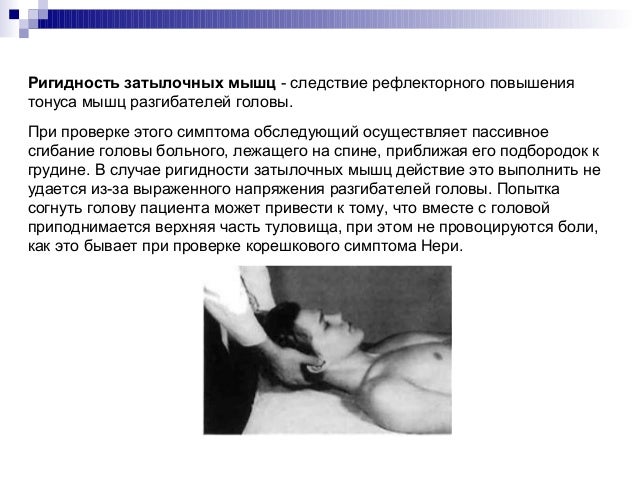 Защемление нервов грудного отдела позвоночника