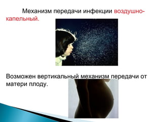 Механизм передачи инфекции воздушно- 
капельный. 
Возможен вертикальный механизм передачи от 
матери плоду. 
 