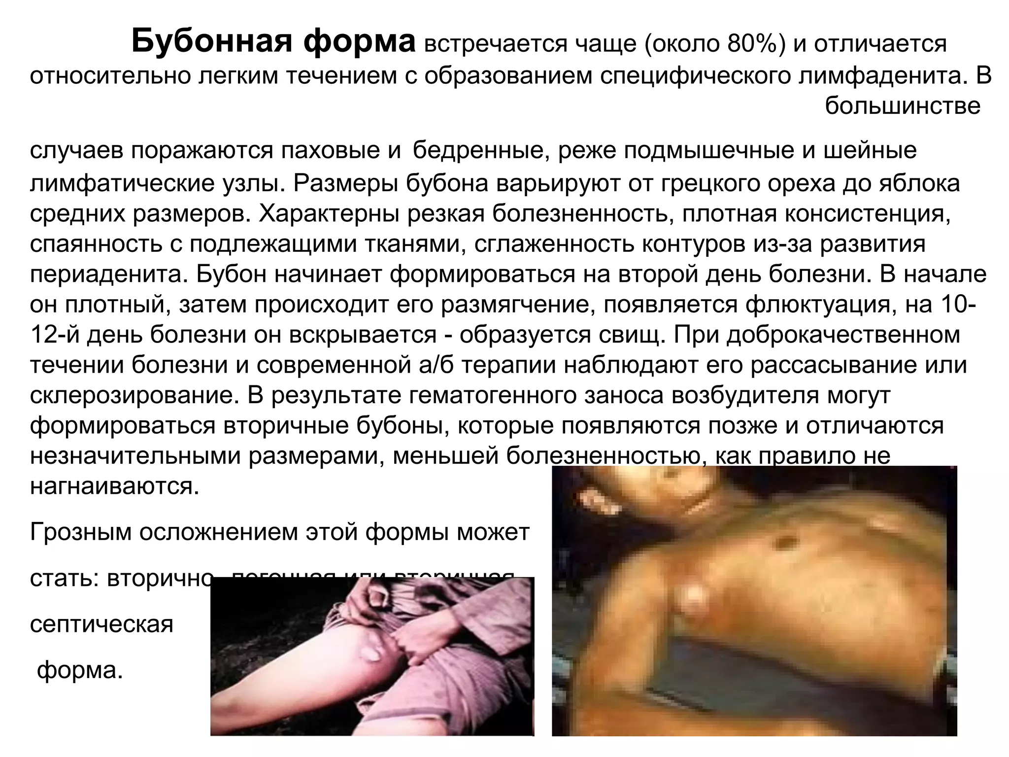 Бубонная форма встречается чаще (около 80%) и отличается 
относительно легким течением с образованием специфического лимфаденита. В 
большинстве 
случаев поражаются паховые и бедренные, реже подмышечные и шейные 
лимфатические узлы. Размеры бубона варьируют от грецкого ореха до яблока 
средних размеров. Характерны резкая болезненность, плотная консистенция, 
спаянность с подлежащими тканями, сглаженность контуров из-за развития 
периаденита. Бубон начинает формироваться на второй день болезни. В начале 
он плотный, затем происходит его размягчение, появляется флюктуация, на 10- 
12-й день болезни он вскрывается - образуется свищ. При доброкачественном 
течении болезни и современной а/б терапии наблюдают его рассасывание или 
склерозирование. В результате гематогенного заноса возбудителя могут 
формироваться вторичные бубоны, которые появляются позже и отличаются 
незначительными размерами, меньшей болезненностью, как правило не 
нагнаиваются. 
Грозным осложнением этой формы может 
стать: вторично- легочная или вторичная 
септическая 
форма. 
 