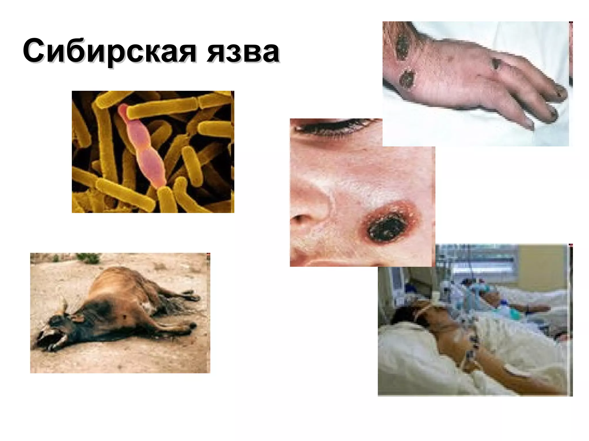 ССииббииррссккааяя яяззвваа 
 