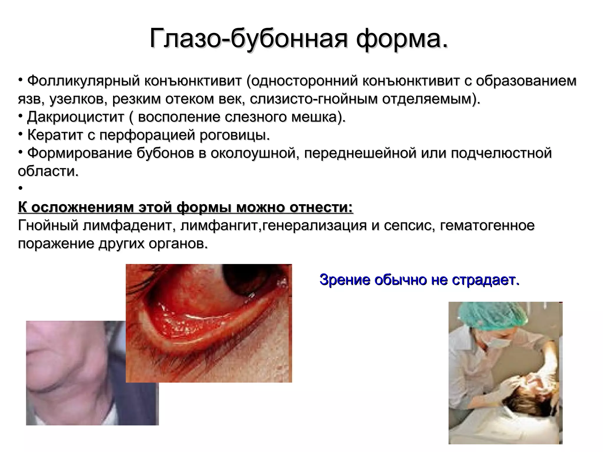 ГГллааззоо--ббууббооннннааяя ффооррммаа.. 
• ФФооллллииккуулляяррнныыйй ккооннъъююннккттииввиитт ((ооддннооссттоорроонннниийй ккооннъъююннккттииввиитт сс ооббррааззооввааннииеемм 
яяззвв,, ууззееллккоовв,, ррееззккиимм ооттееккоомм ввеекк,, ссллииззииссттоо--ггннооййнныымм ооттддеелляяееммыымм)).. 
• ДДааккррииооццииссттиитт (( ввооссппооллееннииее ссллееззннооггоо ммеешшккаа)).. 
• ККееррааттиитт сс ппееррффооррааццииеейй ррооггооввииццыы.. 
• ФФооррммииррооввааннииее ббууббоонноовв вв ооккооллооуушшнноойй,, ппееррееддннеешшееййнноойй ииллии ппооддччееллююссттнноойй 
ооббллаассттии.. 
• 
КК ооссллоожжннеенниияямм ээттоойй ффооррммыы ммоожжнноо ооттннеессттии:: 
ГГннооййнныыйй ллииммффааддеенниитт,, ллииммффааннггиитт,,ггееннееррааллииззаацциияя ии ссееппссиисс,, ггееммааттооггееннннооее 
ппоорраажжееннииее ддррууггиихх ооррггаанноовв.. 
ЗЗррееннииее ооббыыччнноо ннее ссттррааддааеетт.. 
 