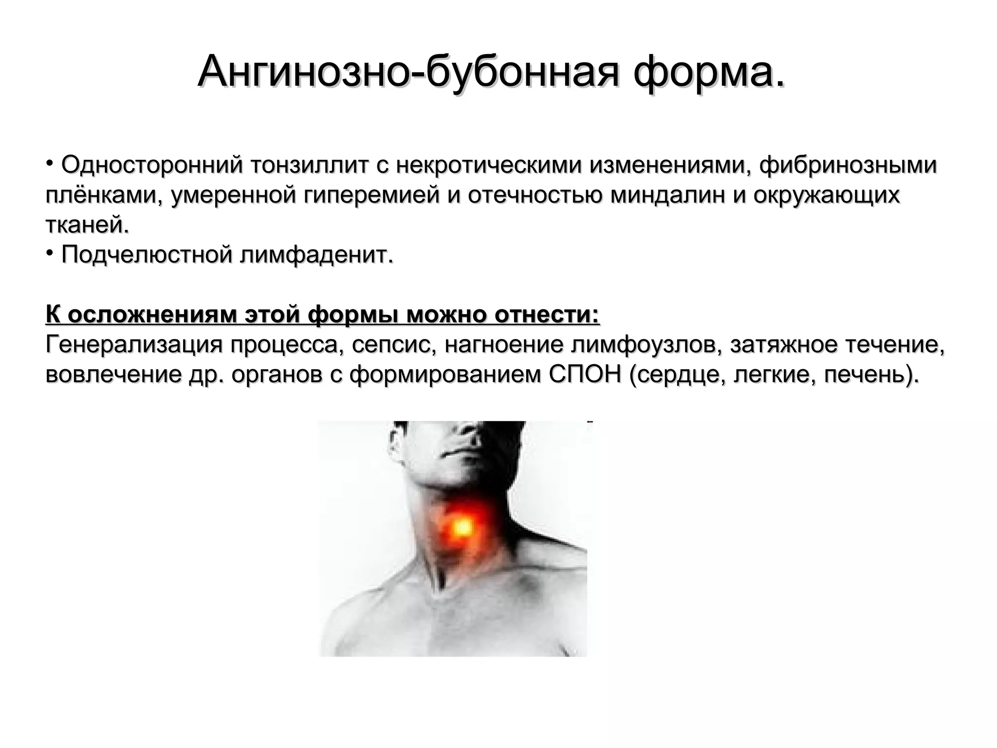 ААннггииннооззнноо--ббууббооннннааяя ффооррммаа.. 
• ООддннооссттоорроонннниийй ттооннззииллллиитт сс ннееккррооттииччеессккииммии ииззммееннеенниияяммии,, ффииббррииннооззнныыммии 
ппллёённккааммии,, ууммеерреенннноойй ггииппееррееммииеейй ии ооттееччннооссттььюю ммииннддааллиинн ии ооккрруужжааюющщиихх 
ттккааннеейй.. 
• ППооддччееллююссттнноойй ллииммффааддеенниитт.. 
КК ооссллоожжннеенниияямм ээттоойй ффооррммыы ммоожжнноо ооттннеессттии:: 
ГГееннееррааллииззаацциияя ппррооццеессссаа,, ссееппссиисс,, ннааггннооееннииее ллииммффооууззллоовв,, ззааттяяжжннооее ттееччееннииее,, 
ввооввллееччееннииее ддрр.. ооррггаанноовв сс ффооррммииррооввааннииеемм ССППООНН ((ссееррддццее,, ллееггккииее,, ппееччеенньь)).. 
 