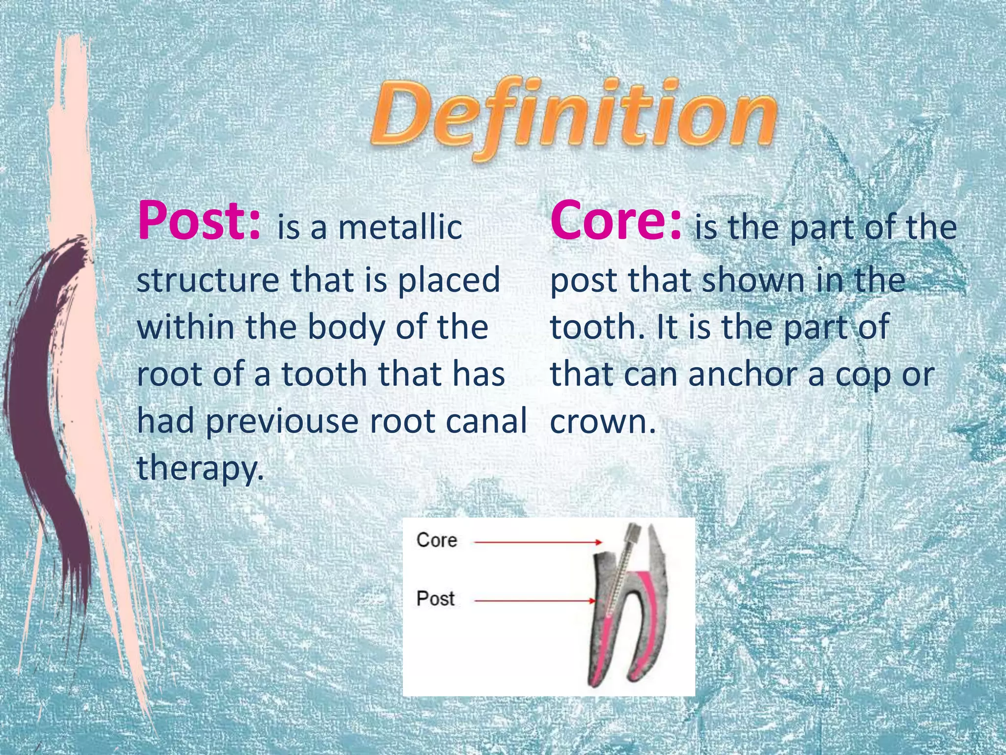 Post: is a metallic 
structure that is placed 
within the body of the 
root of a tooth that has 
had previouse root canal 
therapy. 
Core: is the part of the 
post that shown in the 
tooth. It is the part of 
that can anchor a cop or 
crown. 
 