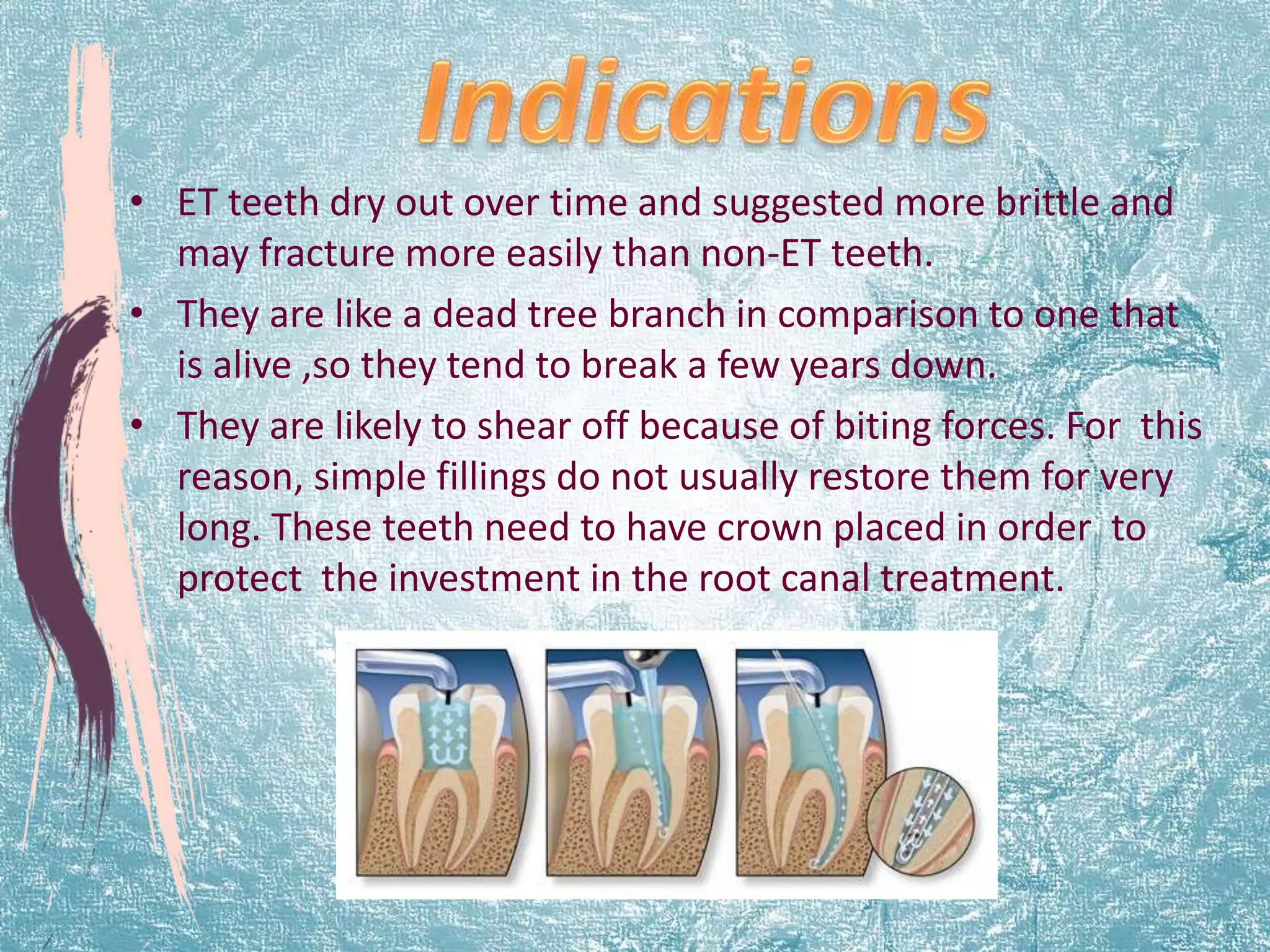 • ET teeth dry out over time and suggested more brittle and 
may fracture more easily than non-ET teeth. 
• They are like a dead tree branch in comparison to one that 
is alive ,so they tend to break a few years down. 
• They are likely to shear off because of biting forces. For this 
reason, simple fillings do not usually restore them for very 
long. These teeth need to have crown placed in order to 
protect the investment in the root canal treatment. 
 