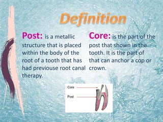 dental post and core | PPTX