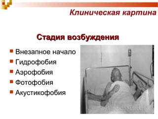 Клиническая картина 
ССттааддиияя ввооззббуужжддеенниияя 
 Внезапное начало 
 Гидрофобия 
 Аэрофобия 
 Фотофобия 
 Акустикофобия 
 