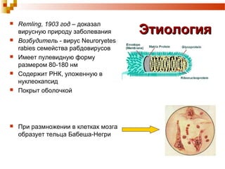  Remling, 1903 год – доказал 
вирусную природу заболевания 
ЭЭттииооллооггиияя  Возбудитель - вирус Neuroryetes 
rabies семейства рабдовирусов 
 Имеет пулевидную форму 
размером 80-180 нм 
 Содержит РНК, уложенную в 
нуклеокапсид 
 Покрыт оболочкой 
 При размножении в клетках мозга 
образует тельца Бабеша-Негри 
 