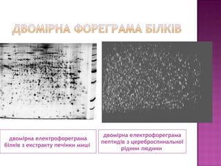 двомірна електрофореграма 
білків з екстракту печінки миші 
двомірна електрофореграма 
пептидів з цереброспинальної 
рідини людини 
 