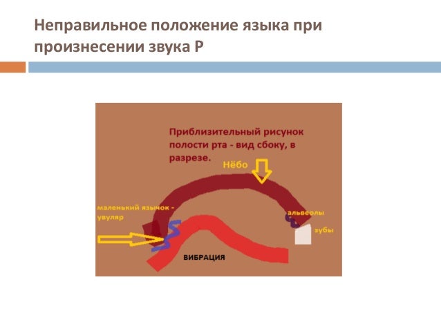 Положение о языке школы. Неправильное положение языка. неправильное расположение языка. положение языка при р. неправильное положение языка во рту.