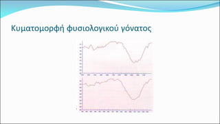 Κυματομορφή φυσιολογικού γόνατος  