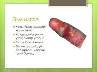 gogii | PPT