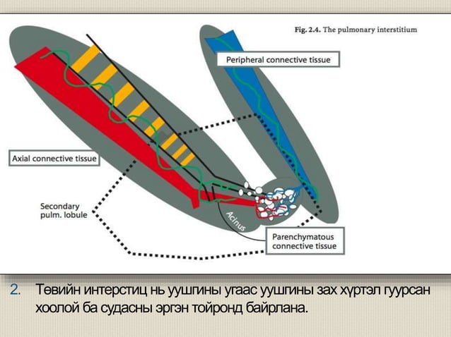 уушигны завсрын эдийн өвчнүүд | PPT