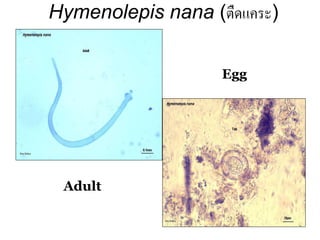 62 
Egg 
Adult 
Hymenolepis nana (ตืดแคระ)  