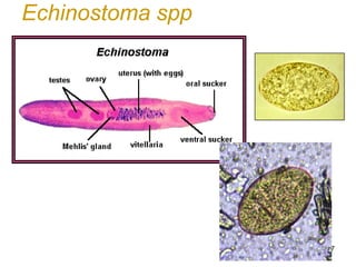67 
Echinostoma spp  
