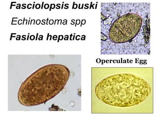 68 
Operculate Egg 
Fasciolopsis buski 
Echinostoma spp 
Fasiola hepatica  