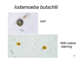 74 
Iodamoeba butschlii 
cyst 
With iodine staining  