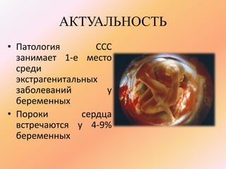 АКТУАЛЬНОСТЬ 
• Патология ССС 
занимает 1-е место 
среди 
экстрагенитальных 
заболеваний у 
беременных 
• Пороки сердца 
встречаются у 4-9% 
беременных 
 
