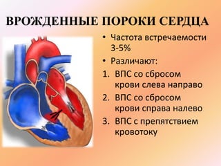 ВРОЖДЕННЫЕ ПОРОКИ СЕРДЦА 
• Частота встречаемости 
3-5% 
• Различают: 
1. ВПС со сбросом 
крови слева направо 
2. ВПС со сбросом 
крови справа налево 
3. ВПС с препятствием 
кровотоку 
 