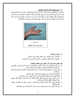 9 
-8 مشض جييف أسبطة سادة اىيذ والأصببع 
٣ؾذس ر ا ؾٌُق ػ ػلاهخ ث ٤ شٓك ر ٤ِق ساؽخ ا ٤ُذ ٝالأفبثغ غٓ ا زُذخ ٤ ،ٖ ؽ ٤ش ٝعذ أ ا زُذخ ٤ 
رـ ٤شاد ك ٢ ا غُ٘ ٤ظ انُب ك ٢ ا ٤ُذ ٣ؤد ١ ك ٢ ا ُٜ٘ب ٣خ إ ٠ُ رقتِ ا لُٔبف ٝا بٌٗٔػ شُثبه ساؽخ ا ٤ُذ. 
ٝ غٓ ا زُذخ ٤ ٛ ب٘ى ا خٗلبك جً ٤ش ك ٢ رذكن ا ذُ إ ٠ُ ا ٤ُذ ٝثؼذ ع ٞ٘اد ا زُذخ ٤ رغجت ك ٢ ا غٗذاد 
- ) الأٝػ ٤خ ا ذُ ٞٓ ٣خ ا ذُه ٤وخ بٓٔ ٣ؤد ١ إ ٠ُ ا زٗؾبس ٤ُل ٢ ٝا بٌٗٔػ ك ٢ أفبثغ ا ٤ُذ. )ؽ 12ٌَ 
-9 الأوجبس والأسبطة 
- .ٖ ا ذُٔخ ٤٘ ػشمخ لا زُٜبة أٝربس ا زٌُق مؼق ؿ ٤ش ا ذُٔخ ٤٘ 
- .ٖ ا ذُٔخ ٤٘ ػشمخ لُا زُٞاء ٝا غٌُٞس ٝالإفبثبد أ ضًش ؿ ٤ش ا ذُٔخ ٤٘ 
-11 دقبئق عيمية دىه آثبس اىحذخيه عيى اىعظب واىمفبصو 
 ثض ٣بدح ذٓح ا زُذخ ٤ ٝص ٣بدح ػذد ا غُغبئش ا غُٔزٜ خٌِ ٣ضداد خطش الإفبثخ ث غٌٞس ا ؼُظب ك ٢ 
ع ا ؾُ ٤خٞخخ ضٓ ا ؼُ ٞٔد ا لُوش ١ ٝػظ ا ُٞسى ٝ لٓق ا شُعؾ. 
 % جًبس ا غُ ا ذُٔخ ٤٘ أ ضًش ػشمخ ؿ ٤ش ا ذُٔخ ٤٘ غٌُش الأهشاف ٝر يُ ث غ٘جخ 34 
.%44 إ ٠ُ 
 .ٖ ٣غزـشم ؽلبء ا غٌُش ذُٟ ا ذُٔخ ٤٘ ٝهذ أ ضًش ؿ ٤ش ا ذُٔخ ٤٘ 
 ٛ ب٘ى كوذا جً ٤ش ك ٢ ضًبكخ ا ؼُظب ذُٟ جًبس ا غُ ا ذُٔخ ٤٘ ؿ ٤ش ا ذُٔخ ٤ٖ٘ . 
 ٣ذخ ٣زؼشم خُطش ا وٗطبع ا طُ شٔ ك ٢ ٝهذ جٓ شٌ ٝ زٗ ٤غخ زُ يُ ٣ٞاعٜ ا غُ٘بء ا ُِٞار ٢ 
ص ٣بدح ك ٢ كوذا ا ؼُظ ٝٛؾبؽخ ك ٢ ا ؼُظب .ّ 
 ٣ؤخش رؾ ػظب عذ ٣ذح ك ٢ ؽب خُ ا غٌُٞس ٝ ٣ؤخش ػ ٤ِٔخ ٞٗٔ ا ؼُظ ك ٢ ػ ٤ِٔبد ا زُذخ ٤ 
رطٞ ٣ ا ؼُظب .ّ 
 ك ٢ ؽب خُ رذخ ٤ ا غُ٘بء ثؼذ ع ا ٤ُأط ٣ض ٣ذ خطش الإفبثخ ث غٌش ك ٢ ػظب ا لُخز. 
) الشكل ) 12 
مرض تليف اليد عند المدخنين 
 