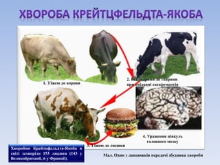 1. З їжею до корови 
2. Від тварини до тварини 
при поїданні екскрементів 
3. З їжею до людини 
4. Ураження півкуль 
головного мозку 
Мал. Один з ланцюжків передачі збудника хвороби 
Хворобою Крейтцфельдта-Якоба в 
світі захворіло 153 людини (143 у 
Великобританії, 6 у Франції). 
 