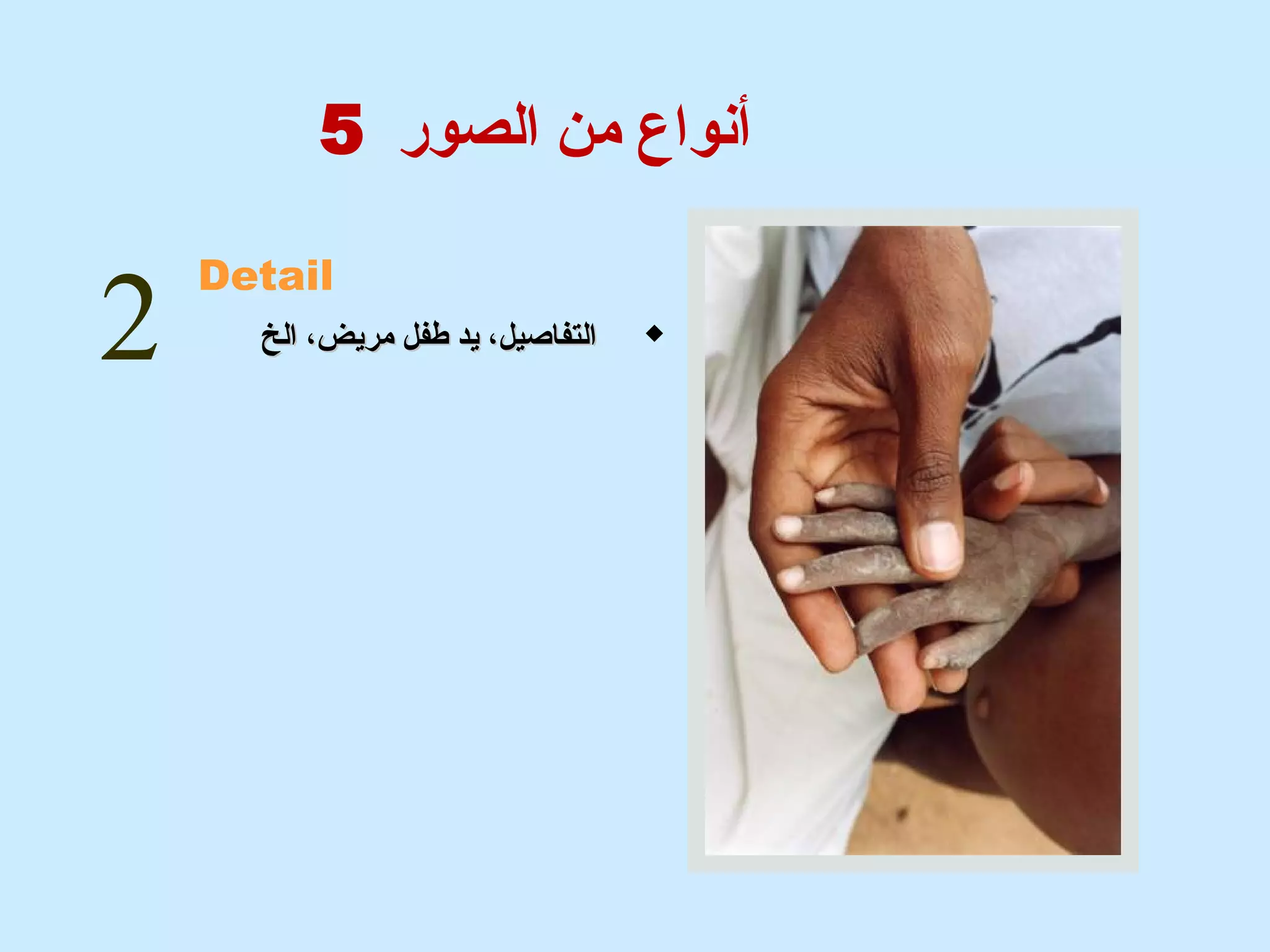 أنشواع من الصور 5 
2 Detail 
االلتتففااصصييلل،، ييدد ططففلل ممررييضض،، االلخخ  
 