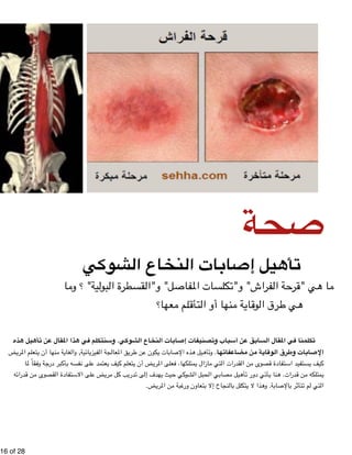 !16 of !28 
صحة 
تأهيل إصابات النخاع الشوكي 
ما هي "قرحة الفراش" و"تكلسات المفاصل" و"القسطرة البولية" ؟ وما 
هي طرق الوقاية منها أو التأقلم معها؟ 
تكلمنا في المقال السابق عن أسباب وتصنيفات إصابات النخاع الشوكي. وسنتكلم في هذا المقال عن تأهيل هذه 
الإصابات وطرق الوقاية من مضاعفاتها. وتأهيل هذه الإصابات يكون عن طريق المعالجة الفيزيائية, والغاية منها أن يتعلم المريض 
كيف يستفيد استفادة قصوى من القدرات التي مازال يمتلكها، فعلى المريض أن يتعلم كيف يعتمد على نفسه بأكبر درجة وفقاً لما 
يمتلكه من قدرات. هنا يأتي دور تأهيل مصابي الحبل الشوكي حيث يهدف إلى تدريب كل مريض على الاستفادة القصوى من قدراته 
التي لم تتأثر بالإصابة. وهذا لا يتكلل بالنجاح إلا بتعاون ورغبة من المريض. 
 