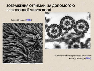 ЗОБРАЖЕННЯ ОТРИМАНІ ЗА ДОПОМОГОЮ 
ЕЛЕКТРОННОЇ МІКРОСКОПІЇ 
Епітелій трахеї (СЕМ) 
Поперечний переріз через джгутики 
хламідомонади (ТЕМ) 
 