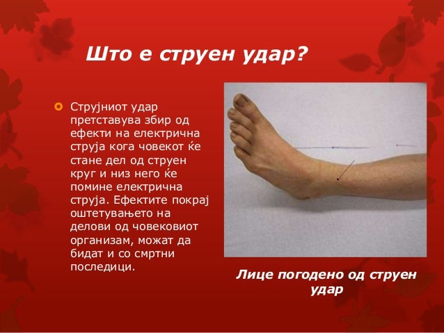 опасност и заштита од струен удар