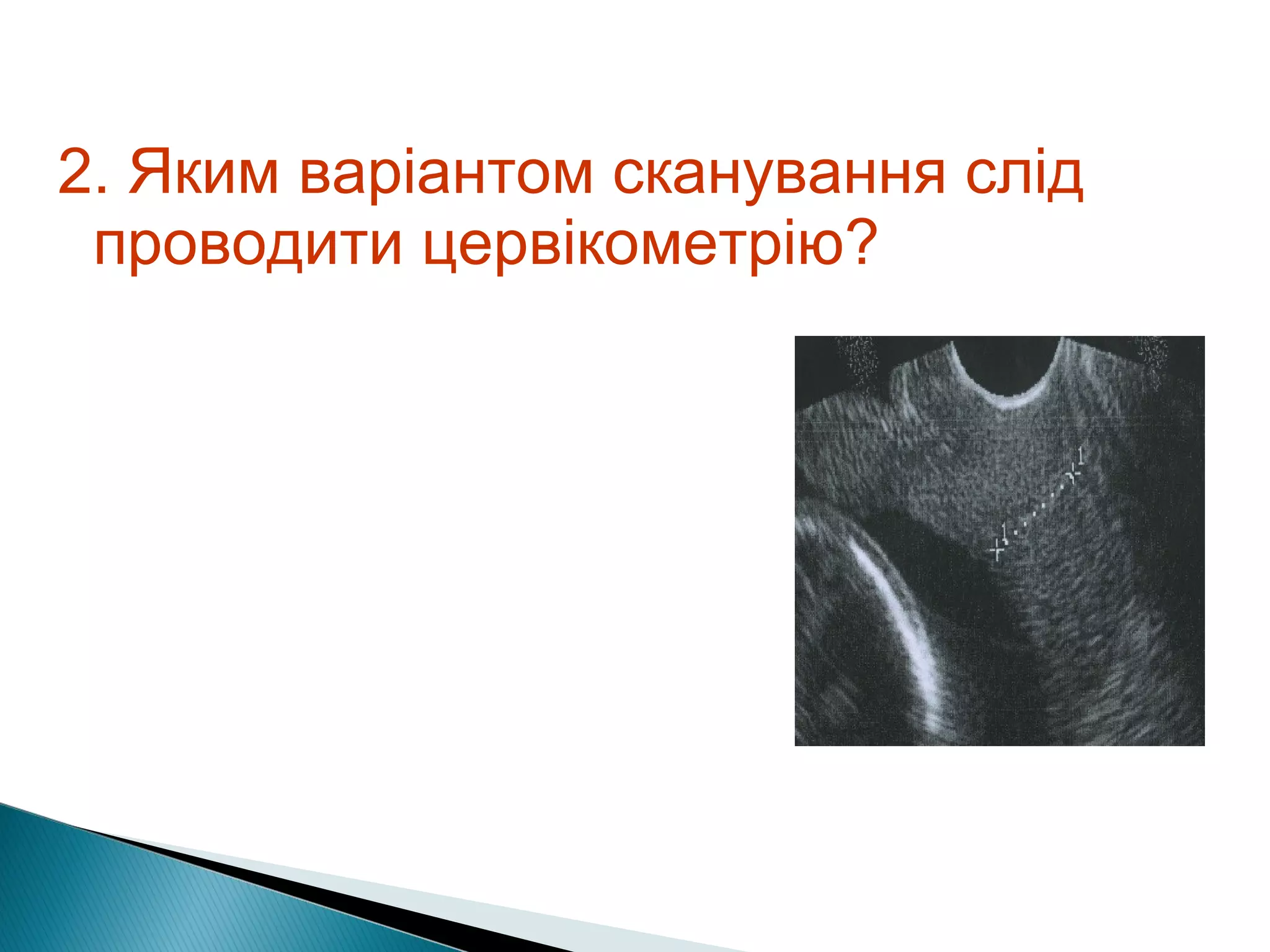 2. Яким варіантом сканування слід 
проводити цервікометрію? 
 