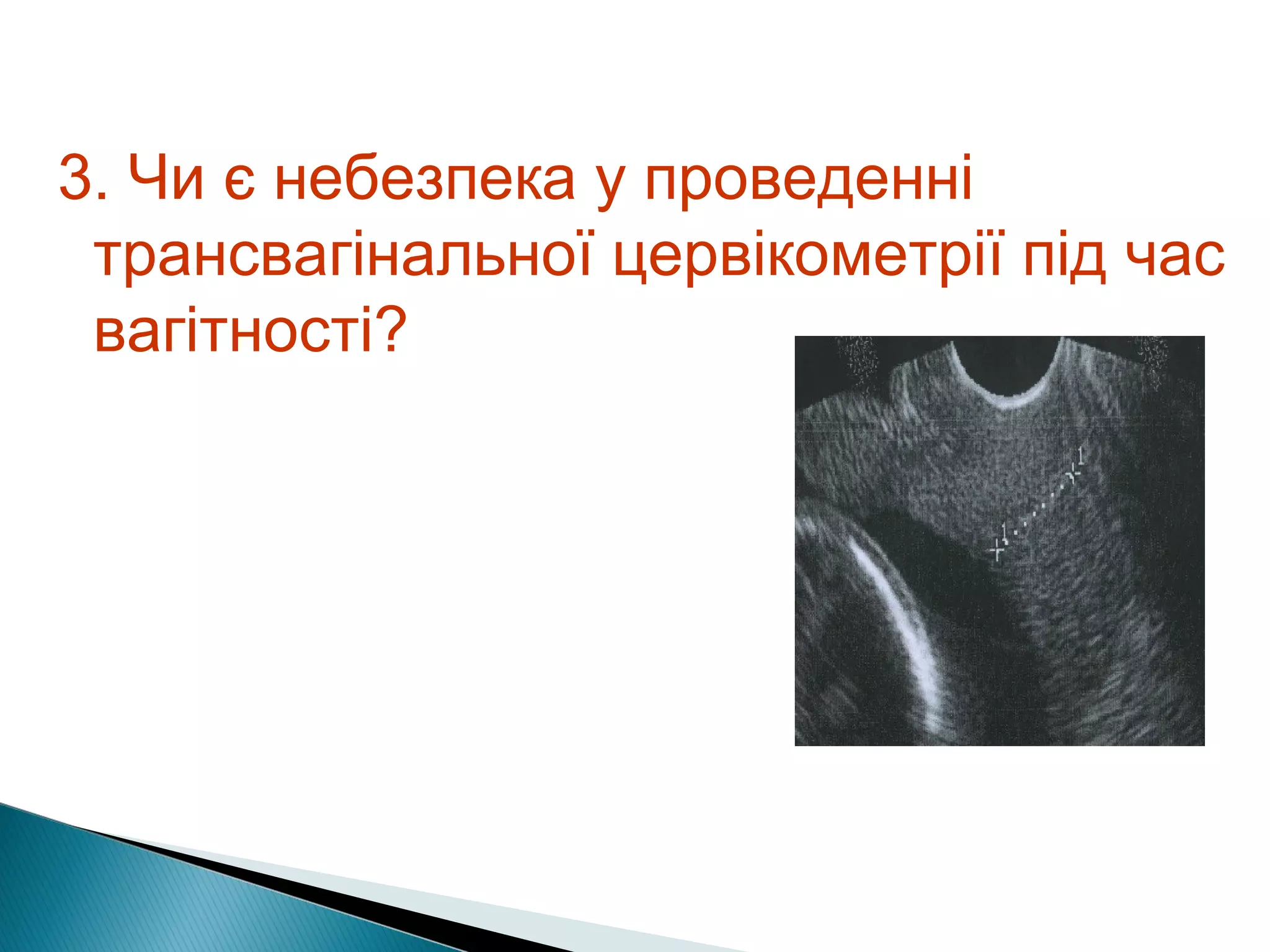 3. Чи є небезпека у проведенні 
транcвагінальної цервікометрії під час 
вагітності? 
 