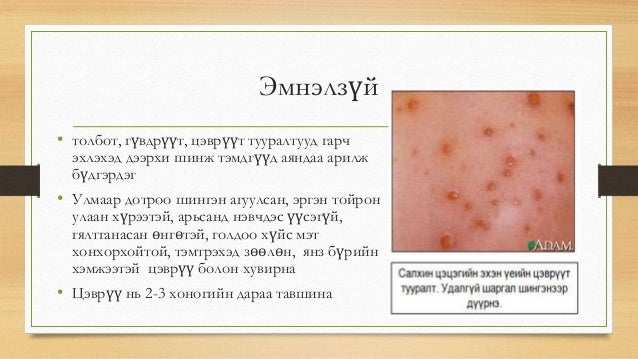 нярайн халдвар