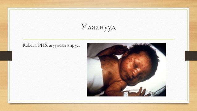 нярайн халдвар