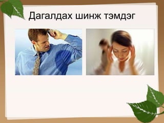 Дагалдах шинж тэмдэг 
 