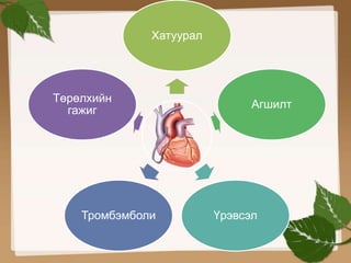 Хатуурал 
Агшилт 
Төрөлхийн 
гажиг 
Тромбэмболи Үрэвсэл 
 