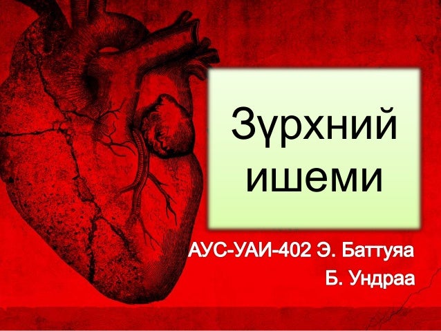 зүрхний ишеми