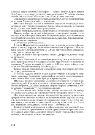 Диференціальна діагностика внутрішніх хвороб