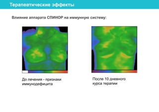Аппараты КВЧ терапии СПИНОР | PPT