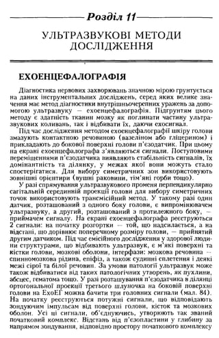 Нервові хвороби. Віничук С. М.,  2001.к-сть сторінок-397