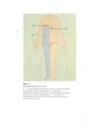 Нервові хвороби. Віничук С. М.,  2001.к-сть сторінок-397
