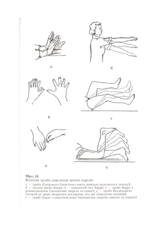 Нервові хвороби. Віничук С. М.,  2001.к-сть сторінок-397